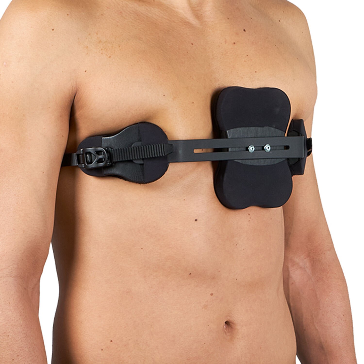 Pectus Carinatum Ortezi Asimetrik (Güvercin Göğsü)