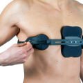 Pectus Carinatum Ortezi Asimetrik (Güvercin Göğsü)