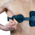 Pectus Carinatum Ortezi Asimetrik (Güvercin Göğsü)